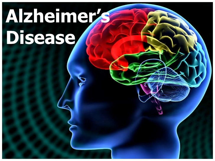 Core One Labs Initiates Treatment of Alzheimer’s Disease Using Psychedelics Compounds