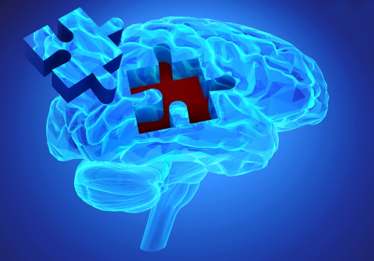 MYND Diagnostics Begins Clinical Research on Alzheimer’s Disease
